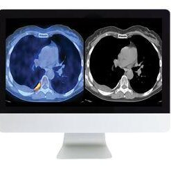 ARRS Practical PET/CT: What You Need to Know