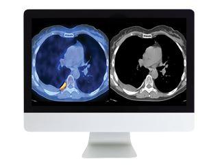 ARRS Practical PET/CT: What You Need to Know