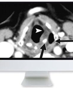 ARRS Thyroid Cancer Therapy: Go High, Go Low, or Go Home 2020