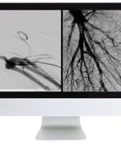 ARRS Vascular and Interventional Radiology Review 2016