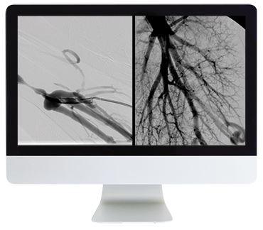 ARRS Vascular and Interventional Radiology Review 2016