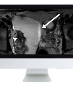 ARRS Women's Imaging 2019