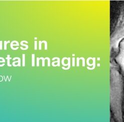 2019 Classic Lectures in Musculoskeletal Imaging: What You Need to Know (CME Videos)