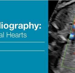 2018 Fetal Echocardiography: Normal and Abnormal Hearts (CME Videos)