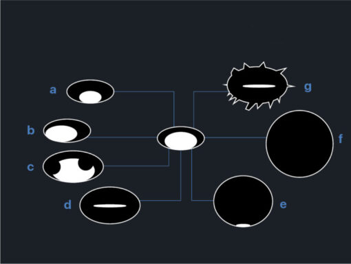 Imaging Mastery Series: Management of Breast Findings