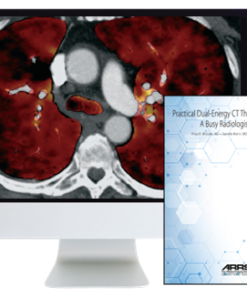 ARRS Practical Dual-Energy CT Throughout the Body 2021 (CME VIDEOS)