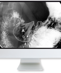 ARRS Clinical Case-Based Review of Abdominal Imaging 2019