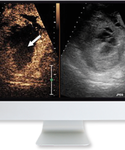 ARRS Clinical Case-Based Review of Ultrasound 2019