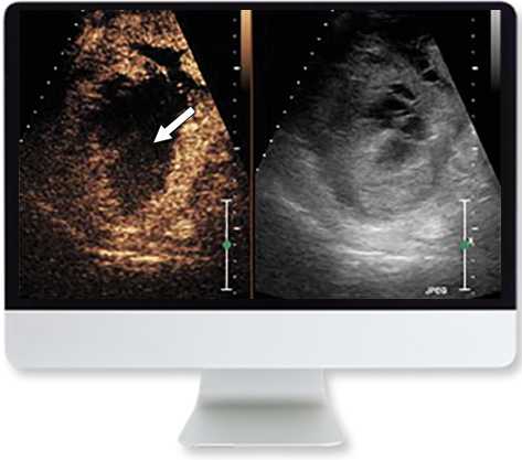 ARRS Clinical Case-Based Review of Ultrasound 2019