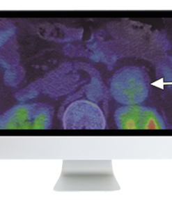 Breakthroughs in Nuclear Medicine for Neurology and Oncology 2021 (CME VIDEOS)