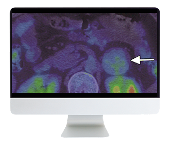 Breakthroughs in Nuclear Medicine for Neurology and Oncology 2021 (CME VIDEOS)