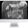 ARRS Practical Pediatric Imaging 2021 (CME VIDEOS)