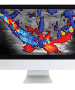 ARRS Thyroid Imaging 2019 (CME VIDEOS)