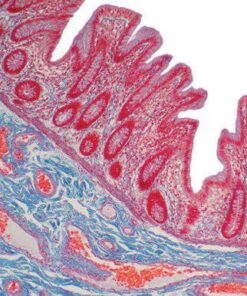 Current Topics in Gastrointestinal and Liver Pathology 2022