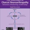 The Essentials of Charcot Neuroarthropathy