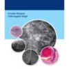 Breast Cancer Mimics is an enthralling collection of case scenarios collected by radiologists across the globe, highlighting the one common line of thought– benign breast lesions that resemble malignancies.