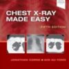 Chest X-Ray Made Easy 5th Edition 2020 Original pdf