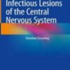 Infectious Lesions of the Central Nervous System 2022 Original pdf