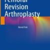 Femoral Revision Arthroplasty original pdf+Video's