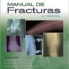 Manual de fracturas/ Handbook of Fractures (Spanish Edition) 2022 High Quality PDF