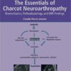 The Essentials of Charcot Neuroarthropathy: Biomechanics, Pathophysiology, and MRI Findings (Original PDF from Publisher)