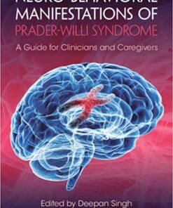 Neuro-behavioral Manifestations of Prader-Willi Syndrome (Original PDF from Publisher)