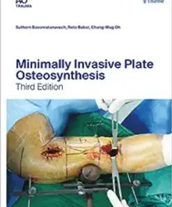 Minimally Invasive Plate Osteosynthesis