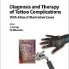 Diagnosis and Therapy of Tattoo Complications: With Atlas of Illustrative Cases (Current Problems in Dermatology, Vol. 52)