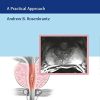 MRI of the Prostate: A Practical Approach