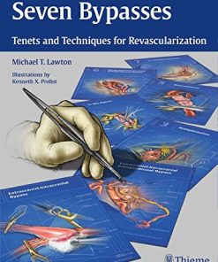 Seven Bypasses: Tenets and Techniques for Revascularization ()