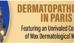 Dermatopathology in Paris Featuring an Unrivaled Collection of Wax Dermatological Models