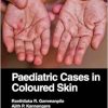 Paediatric Cases in Coloured Skin