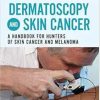 Dermatoscopy and Skin Cancer