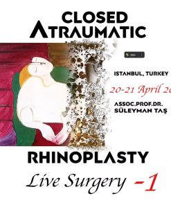 Closed Atraumatic Rhinoplasty