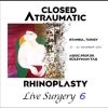 Closed Atraumatic Rhinoplasty Live Surgery