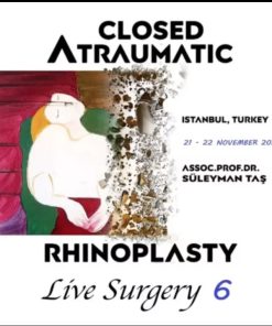 Closed Atraumatic Rhinoplasty Live Surgery