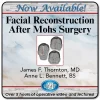 QMP Facial Reconstruction After Mohs Surgery