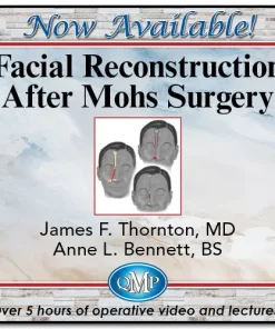 QMP Facial Reconstruction After Mohs Surgery