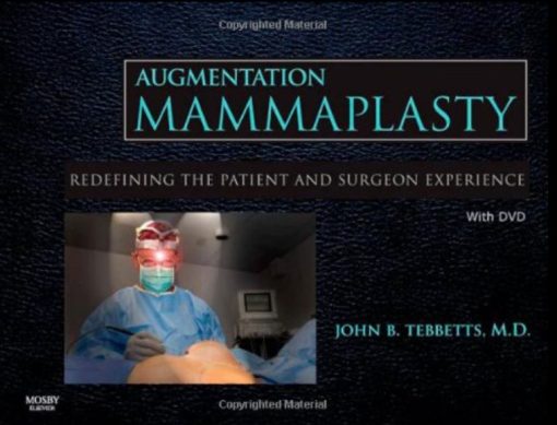 Augmentation Mammaplasty with