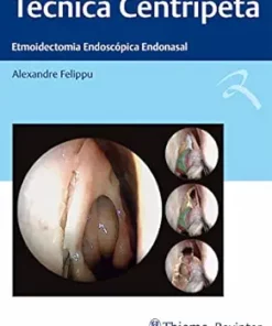 Técnica Centrípeta: Etmoidectomia Endoscópica Endonasal (Portuguese Edition) (EPUB)