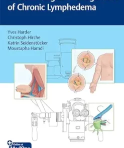 Modern Surgical Management of Chronic Lymphedema (EPUB)