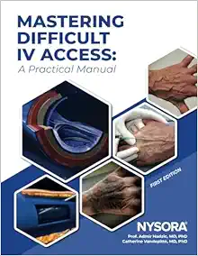 Mastering Difficult IV Access: A Practical Manual (Original PDF from Publisher)