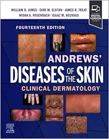 Andrews’ Diseases of the Skin: Clinical Dermatology, 14th Edition (Original PDF from Publisher)