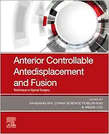 Anterior Controllable Antedisplacement and Fusion: Technique in Spinal Surgery (EPUB)
