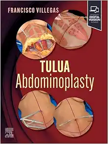 TULUA Abdominoplasty: Transverse Plication Technique (Original PDF from Publisher)