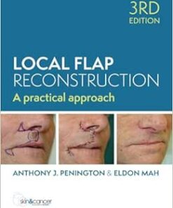 Local Flap Reconstruction, 3rd edition (Original PDF from Publisher)