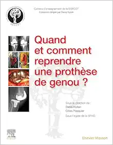 Quand et comment reprendre une prothèse de genou ? (French Edition) (True PDF from Publisher)