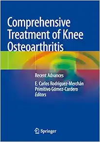 Comprehensive Treatment of Knee Osteoarthritis: Recent Advances, 2020th Edition (Original PDF from Publisher)