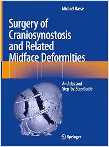Surgery of Craniosynostosis and Related Midface Deformities: An Atlas and Step-by-Step Guide, 2024th Edition (Original PDF from Publisher)