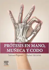 Prótesis en mano, muñeca y codo (True PDF from Publisher)